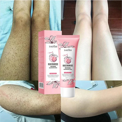 Keratosis Pilaris Repair Treatment Cream Exfoliating Removal