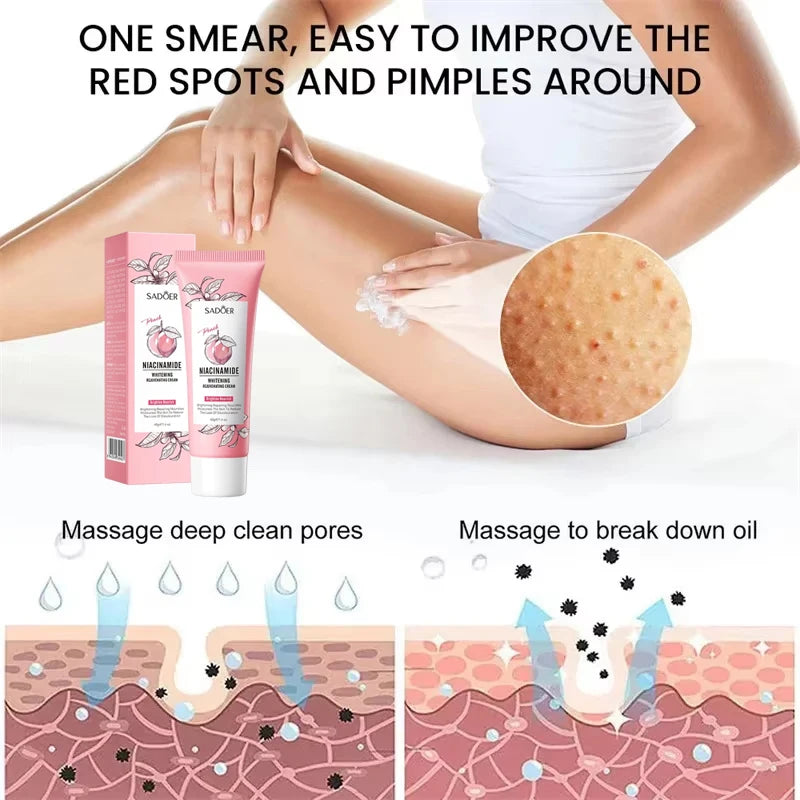 Keratosis Pilaris Repair Treatment Cream Exfoliating Removal